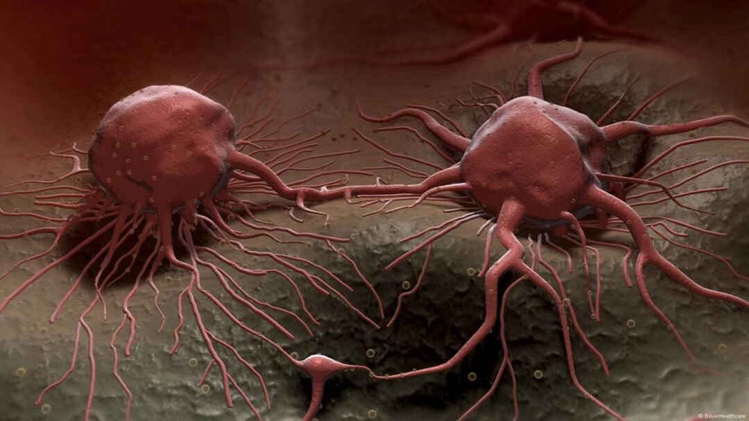 7b8cde76f8c832afe75d7d7e43ad8e31